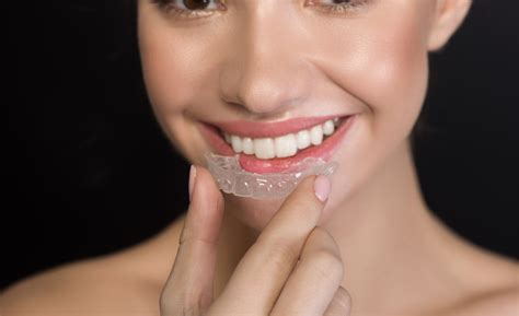 Straighter teeth with clear aligners - Healthy Smile Dental