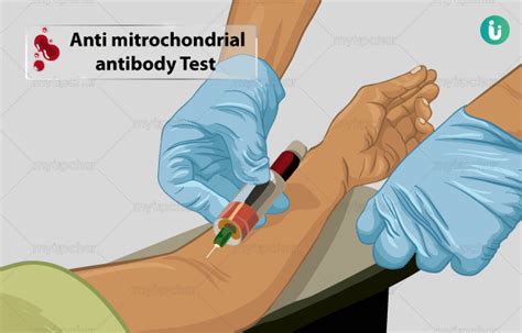 Antimitochondrial antibody (AMA) Test: Procedure, Purpose, Results ...