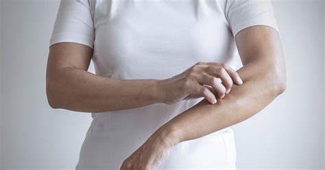 Eczema, Psoriasis & Stress: What to Do About Inflammatory Skin ...