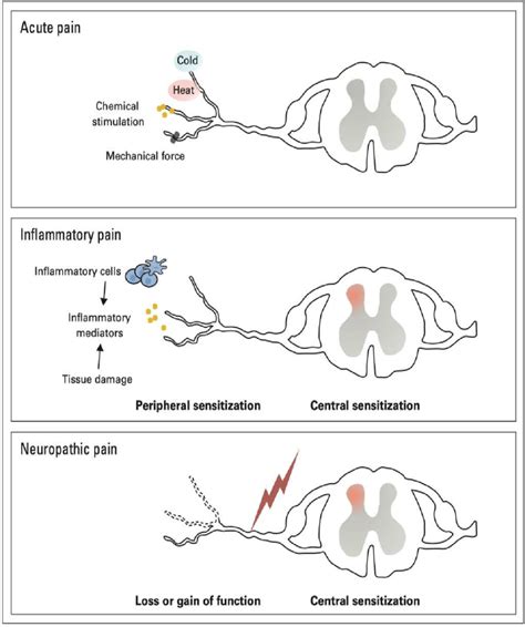 4 Different types of pain. | Download Scientific Diagram