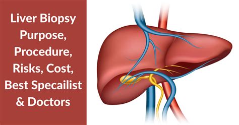 Liver Biopsy Cost, Purpose & Procedure - Yashoda Hospital