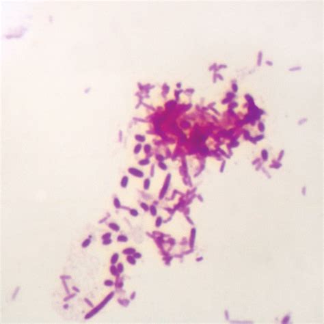 Pseudomonas aeruginosa, w.m. Microscope Slide | Carolina Biological Supply