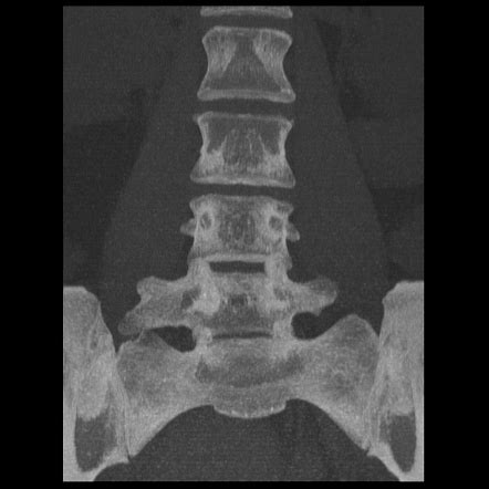 spine vertebrae anatomy