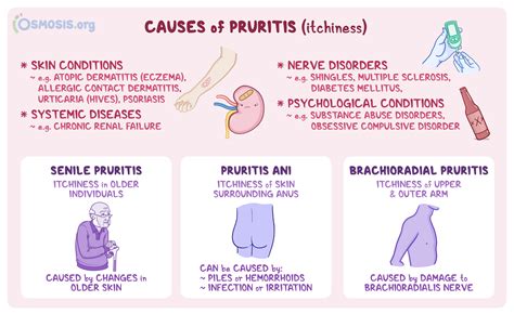 Pruritus: What Is It, Causes, Types, Treatment, and More | Osmosis