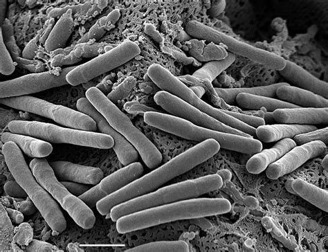 Clostridium Difficile Under Microscope