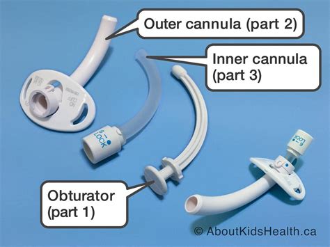 Tracheotomy and tracheostomy tube: How they help your child