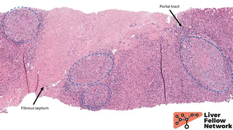 Liver Slide Histology
