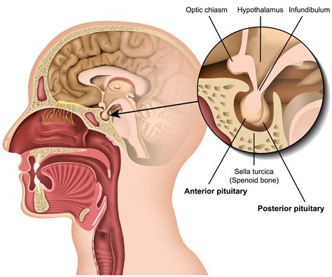 vacío Disciplinario Dependencia pituitary sella Colaborar con equivocado su