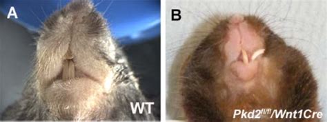 Adult heads of wild type and Pkd2 conditional knockout mice showing ...