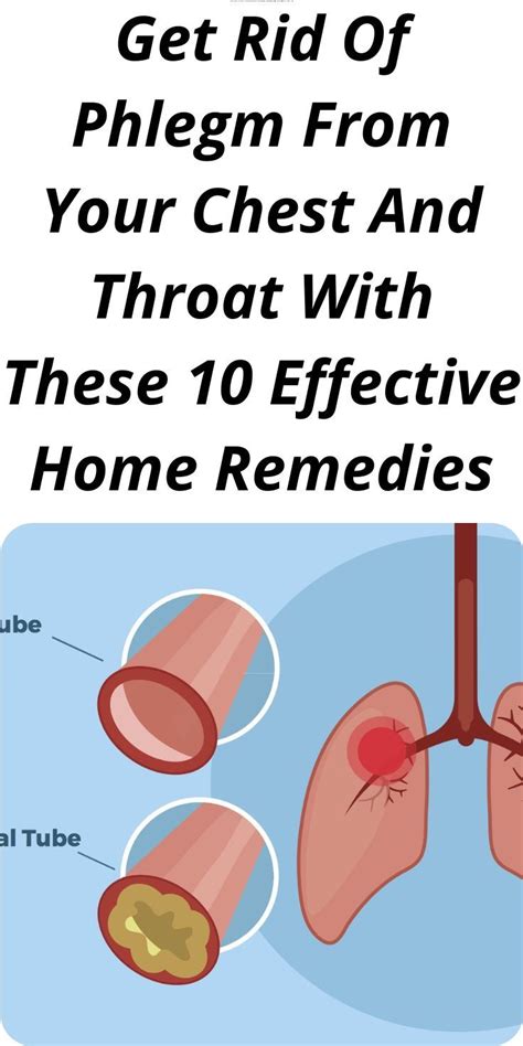 Home Remedies For Phlegm In Throat