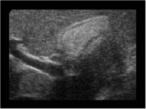 Abdomen and retroperitoneum | 1.2 Gallbladder and bile ducts : Case 1.2 ...