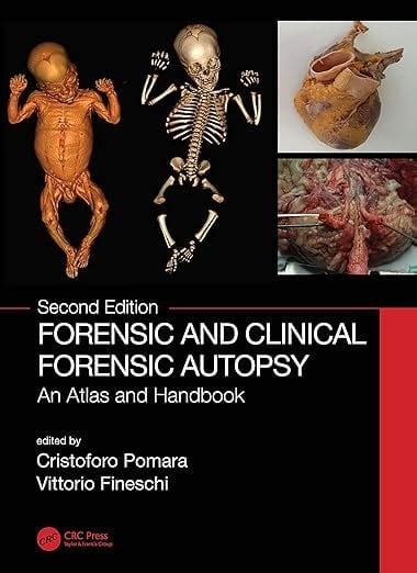 Forensic and Clinical Forensic Autopsy An Atlas and Handbook 2nd ...