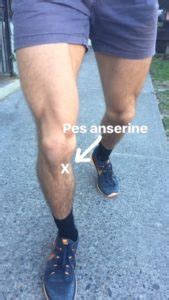 Pes Anserine Bursitis and Tendinopathy | Bend + Mend: Sydney ...