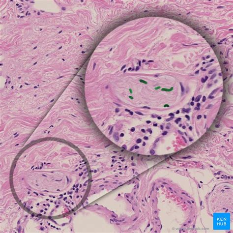 Peripheral nerves: Histology and clinical aspects | Kenhub