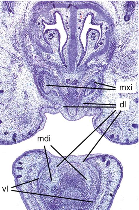 3: Tooth development | Pocket Dentistry