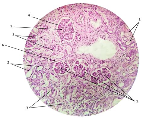 Renal Tubule Histology