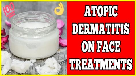 Atopic Dermatitis On Face - Atopic Dermatitis On Face Treatments - YouTube