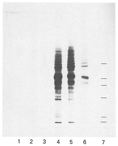 Comparison of surface gangliosides isolated from the three sublines of ...