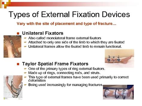 Orthopedic Nursing Part 2 External Fixation Nursing Best