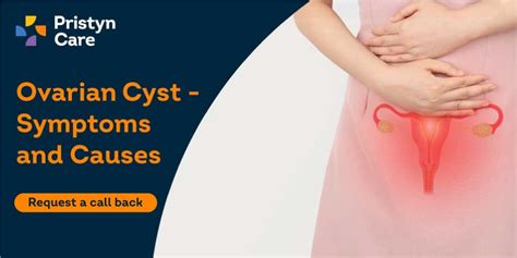 Ovarian Cyst - Symptoms and Causes - Pristyn Care