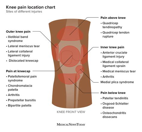 Meniscus Knee Pain Location Chart