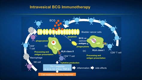 Leonard G. Gomella | Basic Concepts in Bladder Cancer Immunotherapy