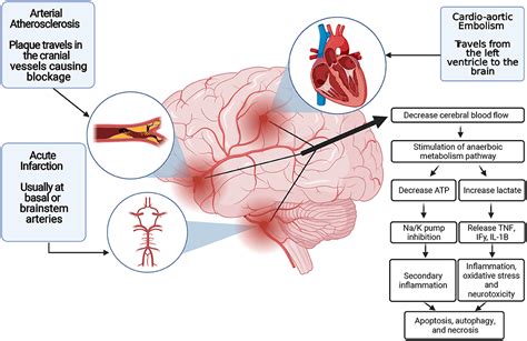 Frontiers | Neuroprotection in Acute Ischemic Stroke: A Battle Against ...