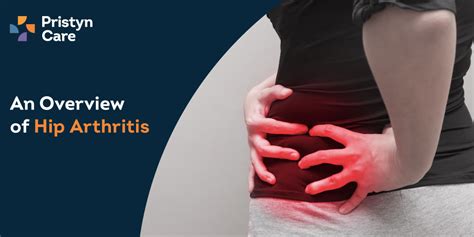 Hip Arthritis - Causes, Symptoms, and Treatment - Pristyn Care