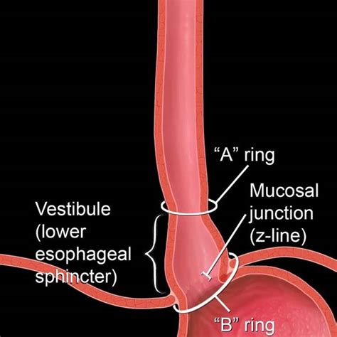 [DIAGRAM] Diagram Of The Lower Esophageal Sphincter - MYDIAGRAM.ONLINE