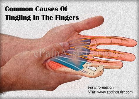 Common Causes Of Tingling In The Fingers | Tingling in fingers ...