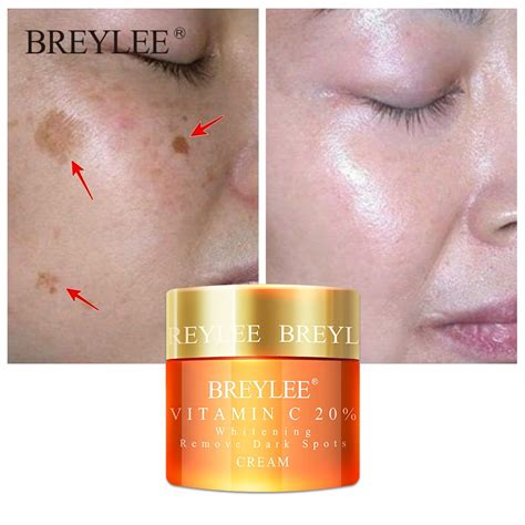 BREYLEE Vitamin C face Cream Whitening Facial VC Freckles Remove Dark ...