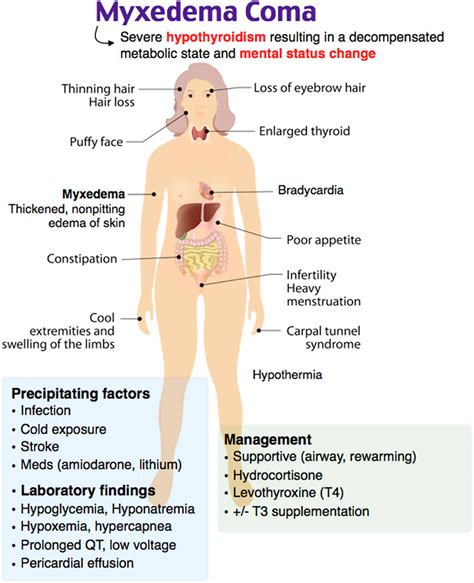 Myxedema coma causes, signs, symptoms, diagnosis, treatment & prognosis