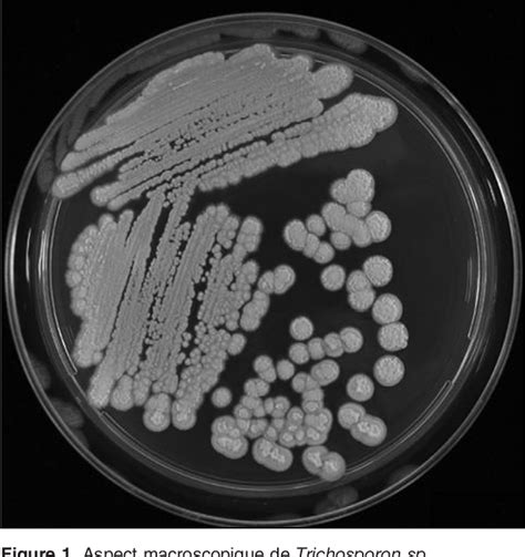 [PDF] [Disseminated Trichosporon asahii infection]. | Semantic Scholar