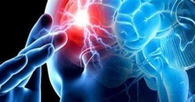 Brain abscess .. its symptoms, causes and complications - World Today News