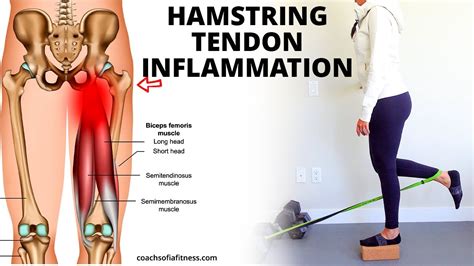 Hamstring Tendinopathy: Best Relief Exercises (Causes and How to Heal ...