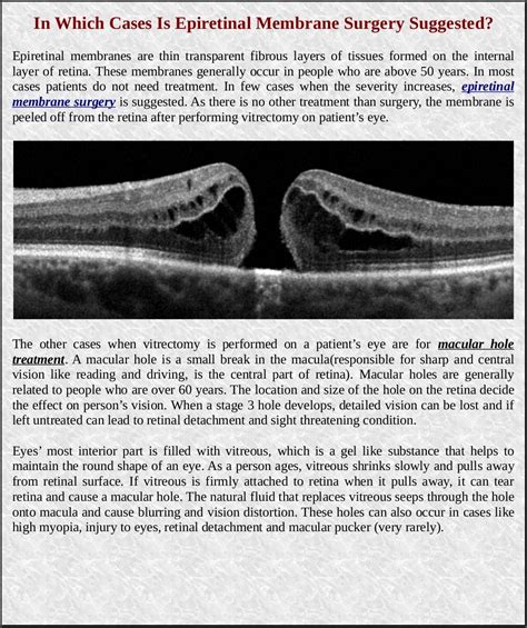 In which cases is epiretinal membrane surgery suggested