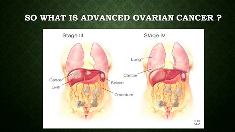 Oxford University surgical lectures: Surgery for the management of ...