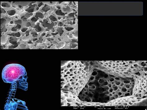 Biomaterials for tissue engineering slideshare