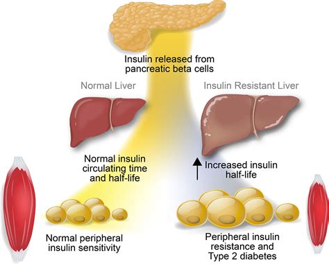 Hepatic insulin receptor: new views on the mechanisms of liver disease ...