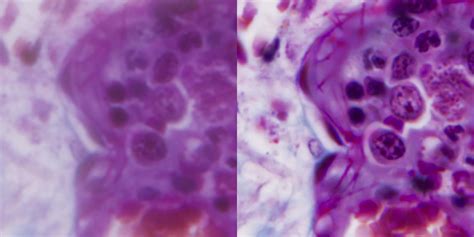 History of Achromatic Microscope Lenses