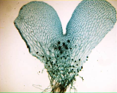 Fern Gametophyte 40X: General Biology Lab: Loyola University Chicago