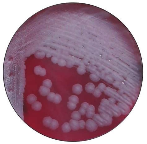 Bacillus anthracis 24-hour growth on sheep blood agar from a swab of a ...