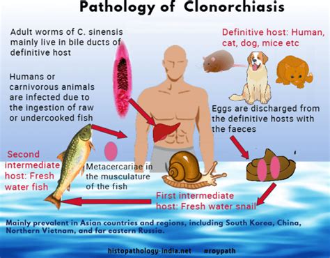 Pathology of Clonorchiasis - Dr Sampurna Roy MD