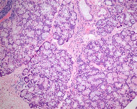 Histology Of Salivary Glands