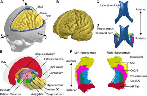 Frontiers | The Presence of the Temporal Horn Exacerbates the ...