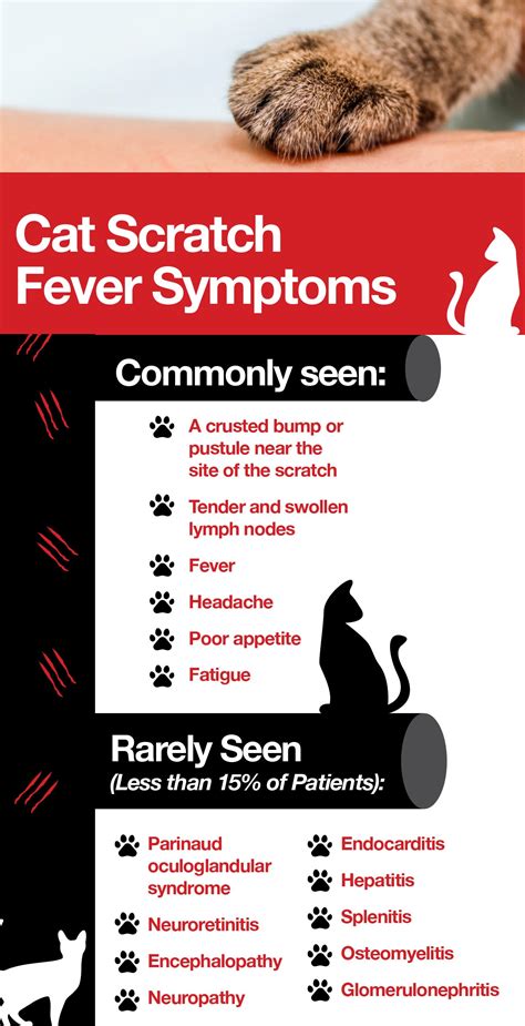 antibiotics for cat scratch disease,Save up to 18%,www.ilcascinone.com