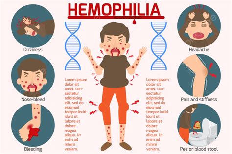 Hemofili Belirti Bilgi Grafikleri öğeleri çizimi Şablon Pngtree'de İndirme