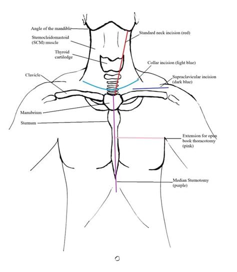 Neck Trauma Trauma Surgery - GMKA - Global Medical Knowledge Alliance