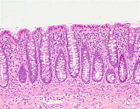 Colon Histology Slides Labeled