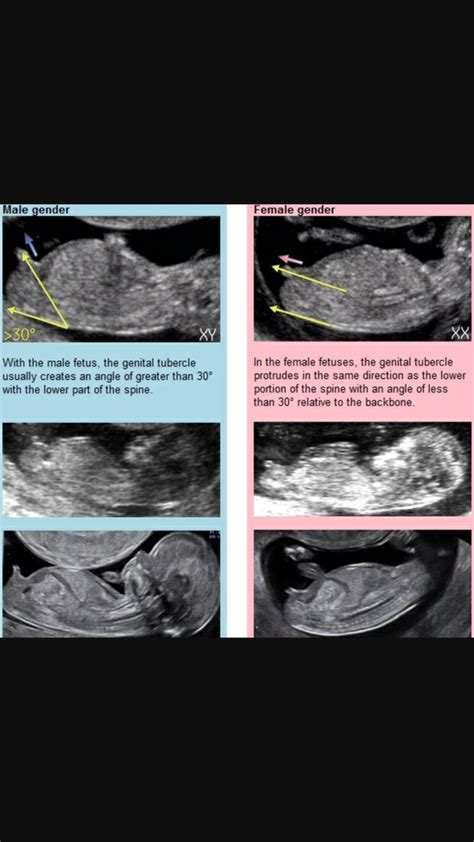 Pin on Sonography